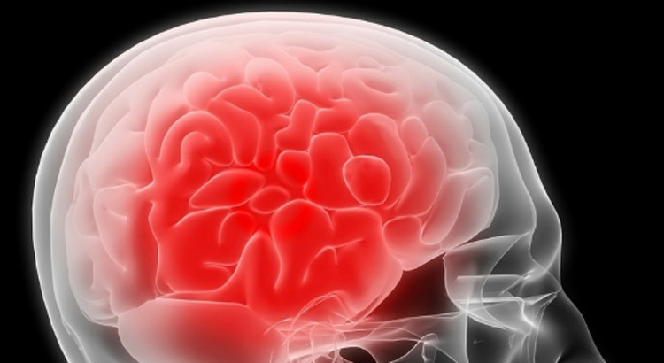 Meningite: cause, sintomi e consigli preventivi