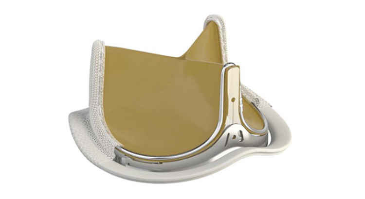 Sanità: impiantata per la prima volta in Puglia una bioprotesi valvolare aortica Sanità: impiantata per la prima volta in Puglia una bioprotesi valvolare aortica